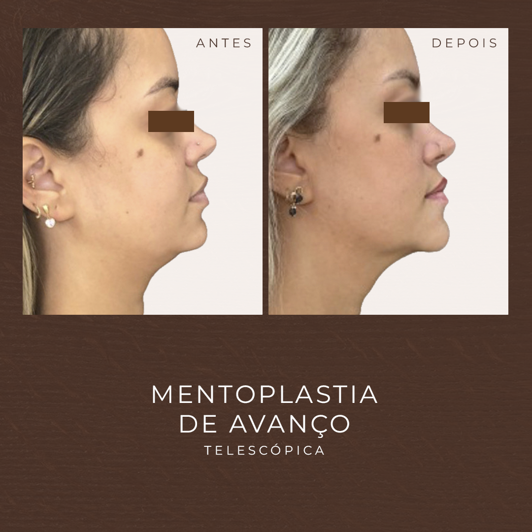 MENTO_1 (1)